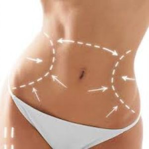 Abdominale