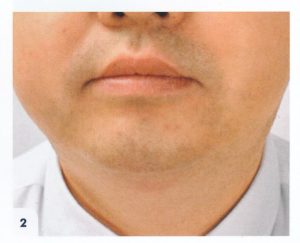 Oval visage 2