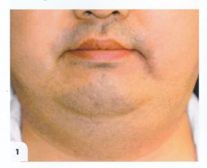 Oval visage 1