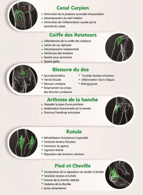 Douleurs articulaires